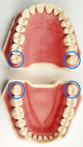 age wisdom teeth fully grown